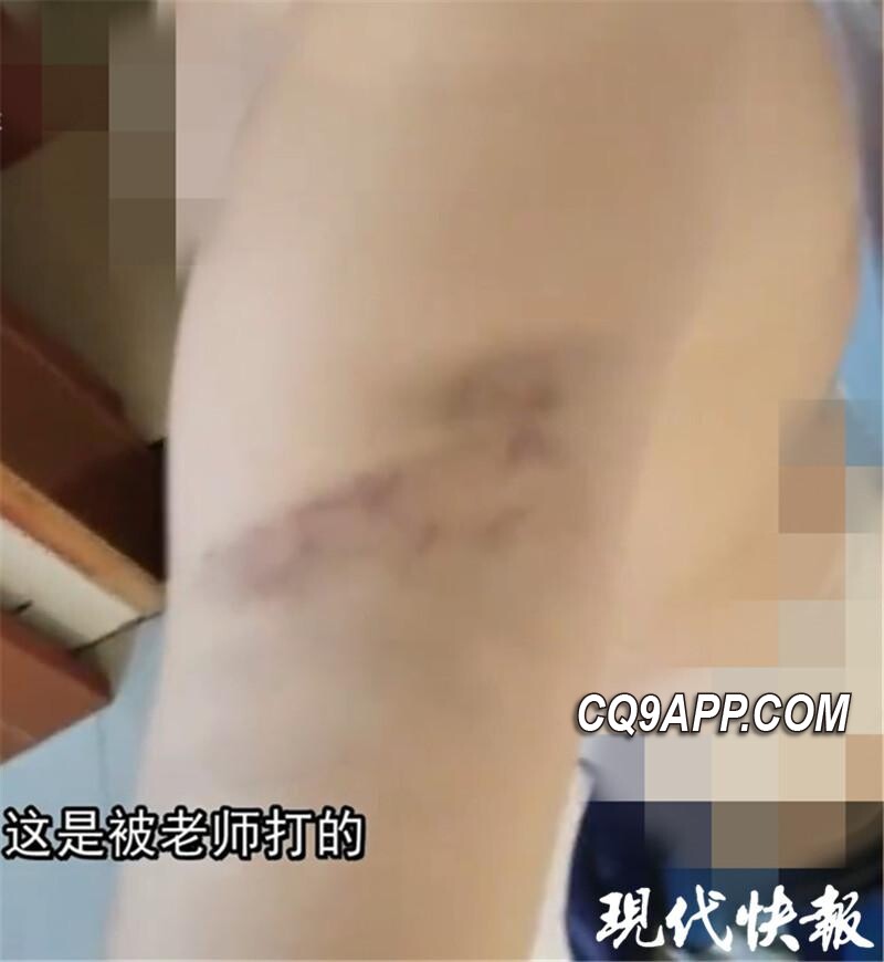 2023121710 南京一小学疑似发生教师体罚事件，区教育局正调查处理